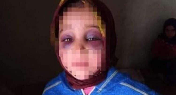 استئنافية آكادير تخفض عقوبة الأستاذ المتهم بتعنيف تلميذته