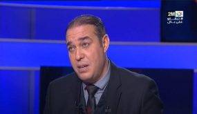 أوزين يعترف بإستغلال موقعه البرلماني لزراعة الشعر مجاناً في تركيا.. وهذه هي التفاصيل!